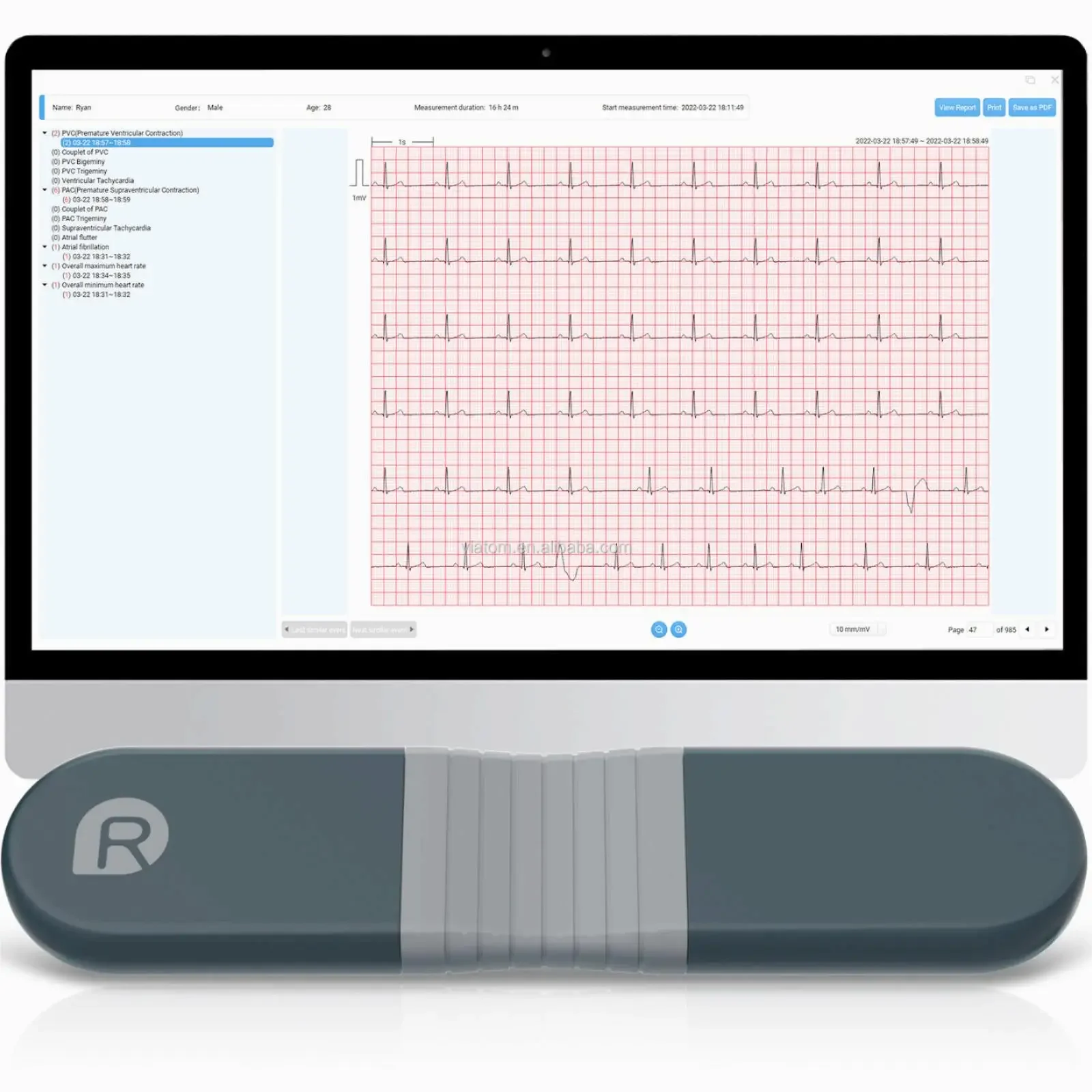 Wireless Bluetooth Dynamic Rec - Ecg Patch Monitor บทวิจารณ์และราคา